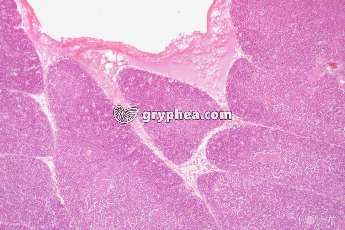 Thymus jeune x25 - gryphea.org